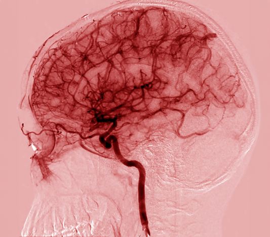 The Connection Between High Blood Pressure and Cognitive Decline